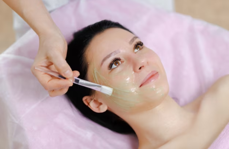 chemical peels for acne scars
