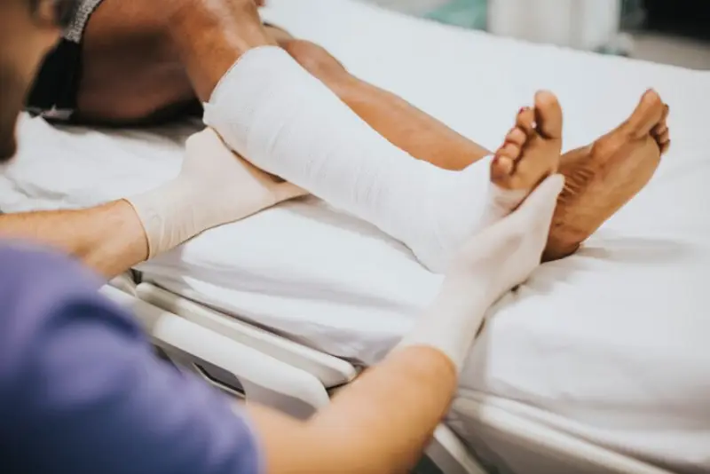 Choosing The Right Specialist For Fracture Treatment In Rohini Delhi