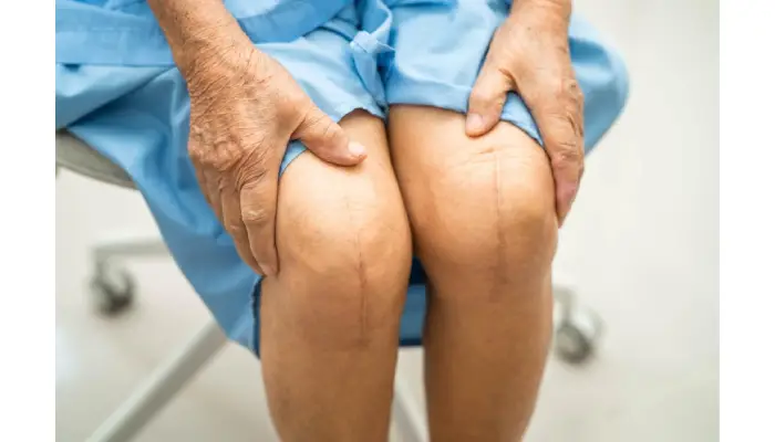 Effective Treatment Options For New Orleans Knee Arthritis