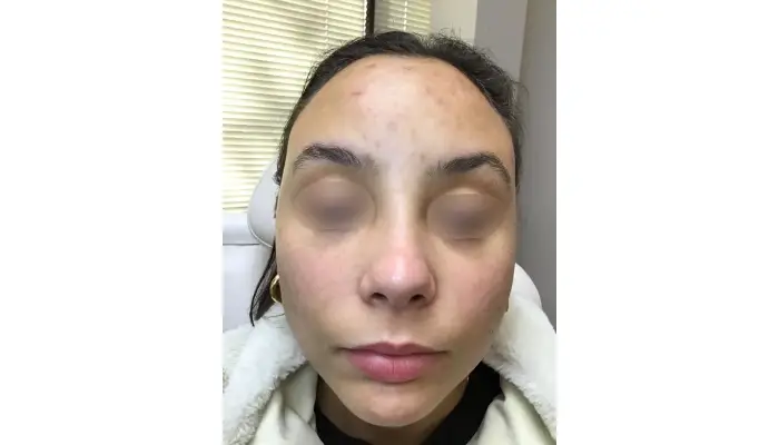 Discovering The Best Dermatologist In Austin: Your Guide To Healthy Skin