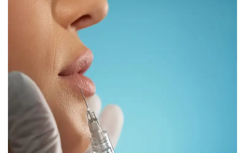 How to Maintain Your Results from Lip Filler in Sacramento?