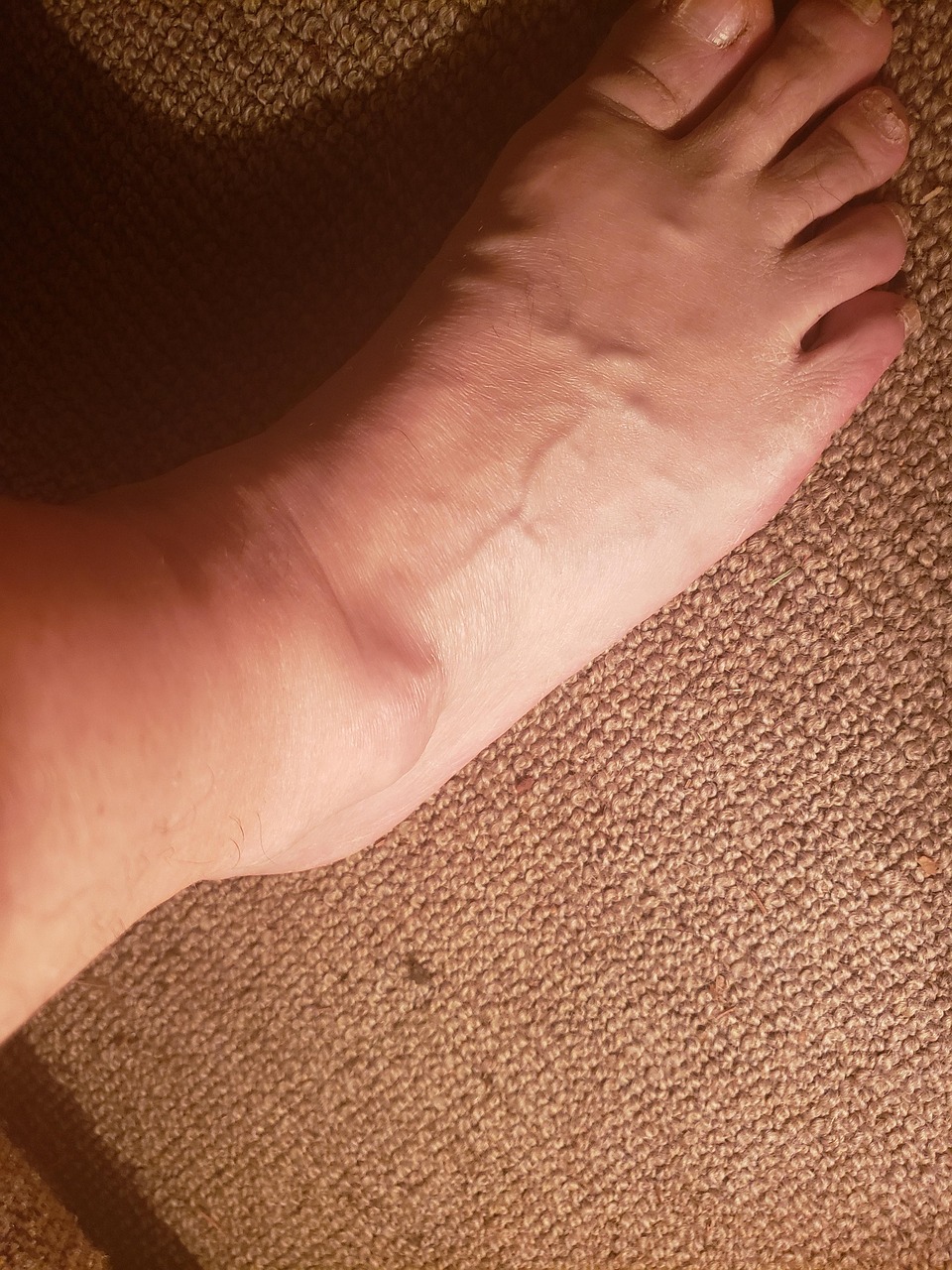 Comprehensive Guide To Ganglion Cyst Of The Wrist And Hand In New Orleans