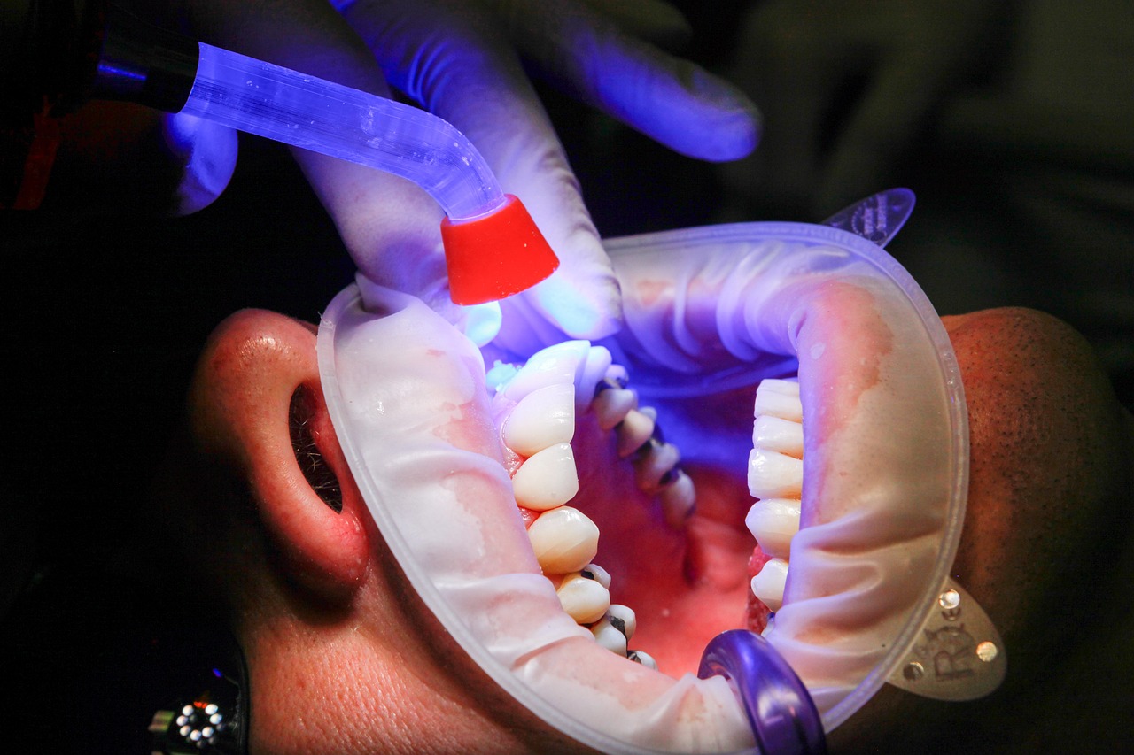 Best Cosmetic Dentists For Veneers In Tucson, AZ