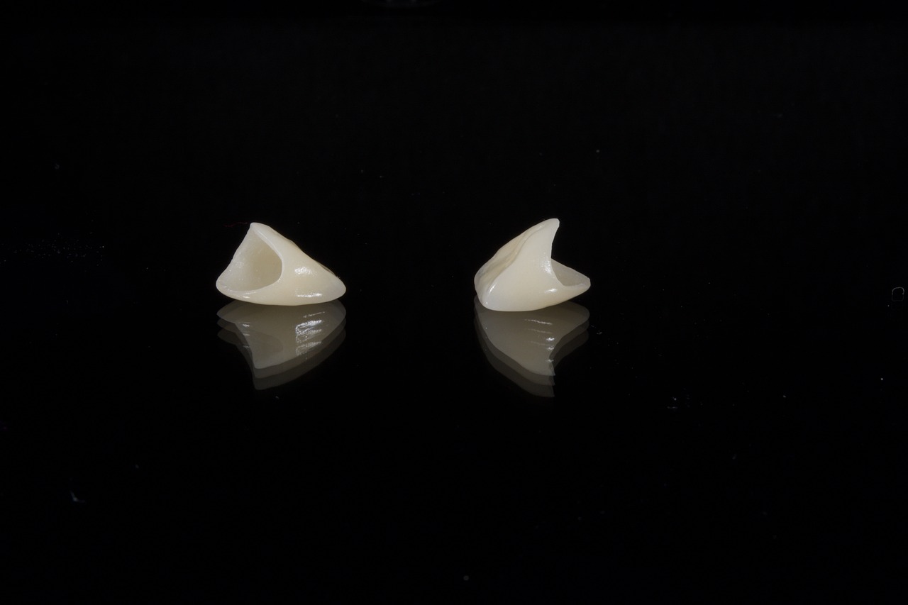 Dental Veneers In Tucson: Before And After Transformations